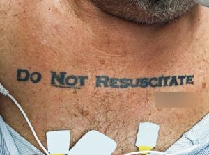 Do Not Resuscitate